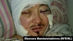 Кадыр Маликов после нападения в больнице