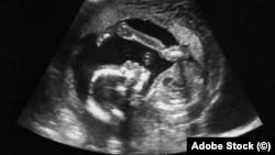 Ультразвуковая диагностика плода